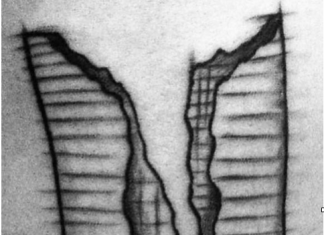 WARS, WALLS AND WORLD – Part 2